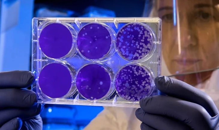 As the coronavirus virus spreads, banks need virology expertise